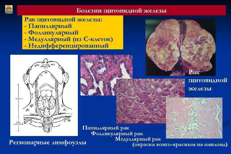 Презентация патология эндокринной системы