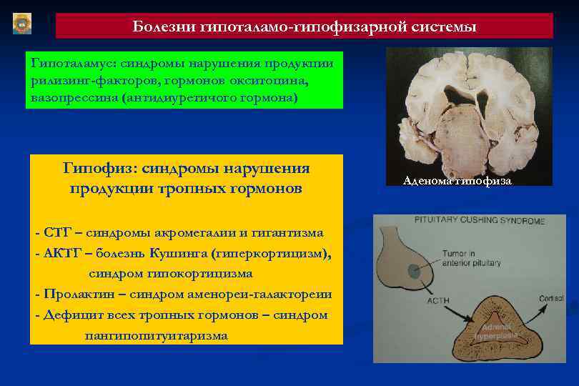 Патологическая анатомия болезней эндокринной системы Болезни гипоталамо