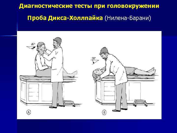 Диагностические тесты при головокружении Проба Дикса-Холлпайка (Нилена-Барани) 