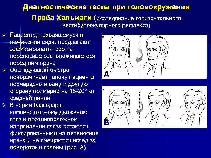 Диагностические тесты при головокружении Проба Хальмаги (исследование горизонтального вестибулоокулярного рефлекса) Ø Пациенту, находящемуся в
