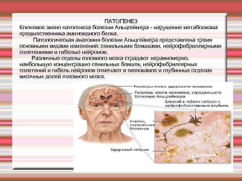 ПАТОГЕНЕЗ Ключевое звено патогенеза болезни Альцгеймера нарушение метаболизма предшественника амилоидного белка. Патологическая анатомия болезни