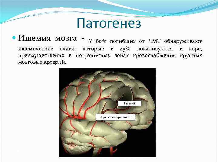 Патогенез Ишемия мозга - У 80% погибших от ЧМТ обнаруживают ишемические очаги, которые в