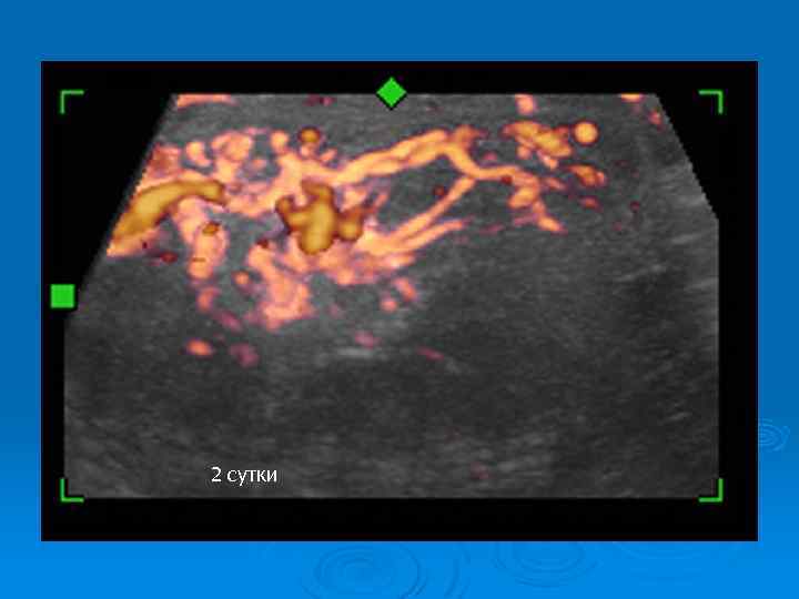 2 сутки 
