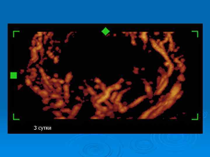 3 сутки 