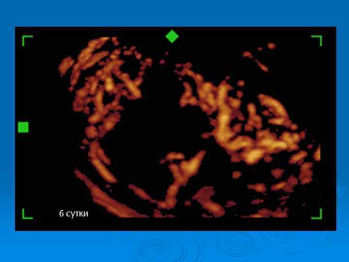 6 сутки 