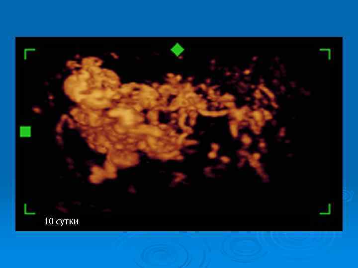10 сутки 