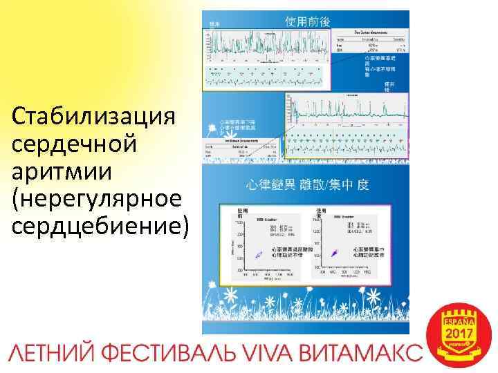 Стабилизация сердечной аритмии (нерегулярное сердцебиение) 