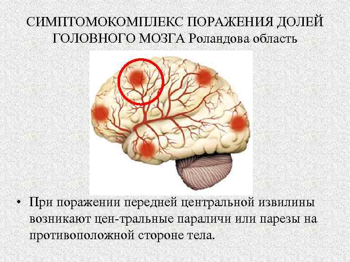 СИМПТОМОКОМПЛЕКС ПОРАЖЕНИЯ ДОЛЕЙ ГОЛОВНОГО МОЗГА Роландова область • При поражении передней центральной извилины возникают