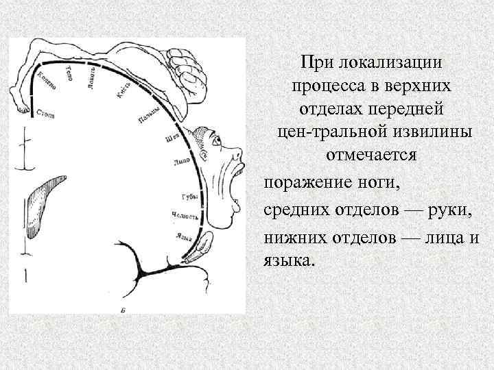 При локализации процесса в верхних отделах передней цен тральной извилины отмечается поражение ноги, средних