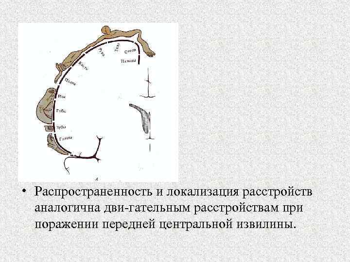  • Распространенность и локализация расстройств аналогична дви гательным расстройствам при поражении передней центральной