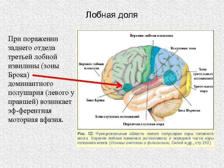 Очаги в коре головного мозга. Заднелобные отделы головного мозга - зона Брока. Строение лобной доли коры головного мозга.