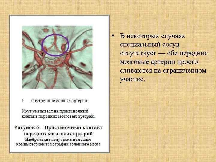  • В некоторых случаях специальный сосуд отсутствует — обе передние мозговые артерии просто