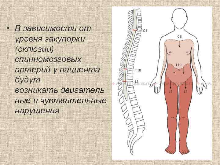  • В зависимости от уровня закупорки (оклюзии) спинномозговых артерий у пациента будут возникать