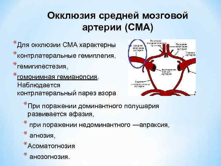 Полная окклюзия. Окклюзия средней мозговой артерии. Окклюзия среднемозговой артерии. Окклюзия задней мозговой артерии. Окклюзия артерий головного мозга.