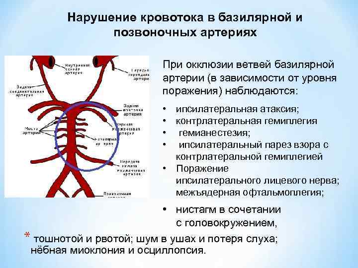 Нарушение кровотока в позвоночных артериях. Окклюзия базилярной артерии. Окклюзия позвоночных артерий. Ветви базилярной артерии. Венозная дисциркуляция головного мозга