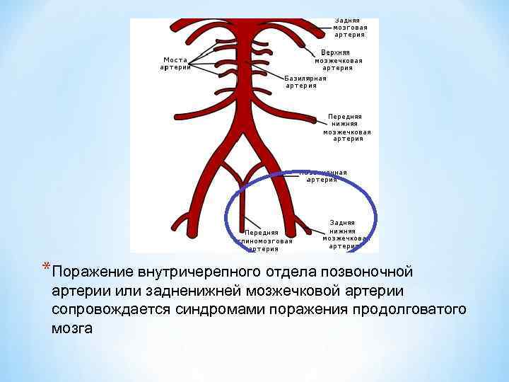 *Поражение внутричерепного отдела позвоночной артерии или задненижней мозжечковой артерии сопровождается синдромами поражения продолговатого мозга