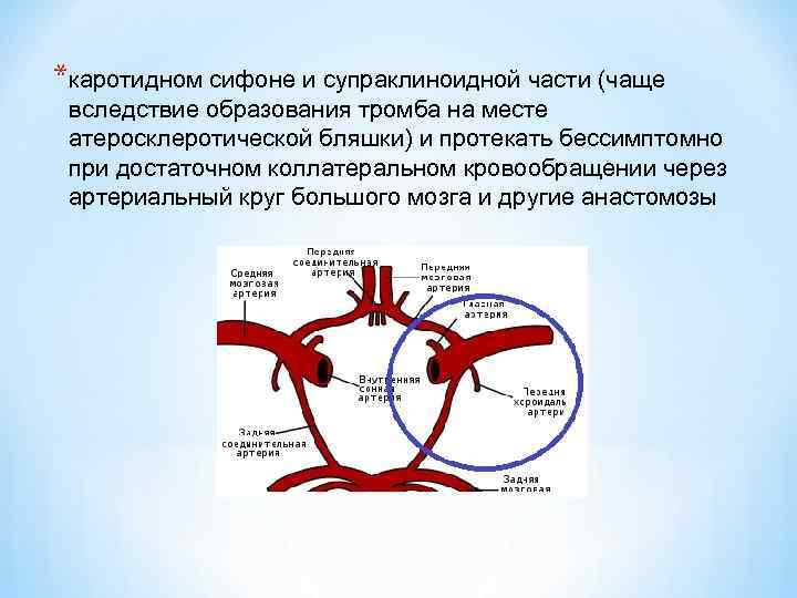 *каротидном сифоне и супраклиноидной части (чаще вследствие образования тромба на месте атеросклеротической бляшки) и