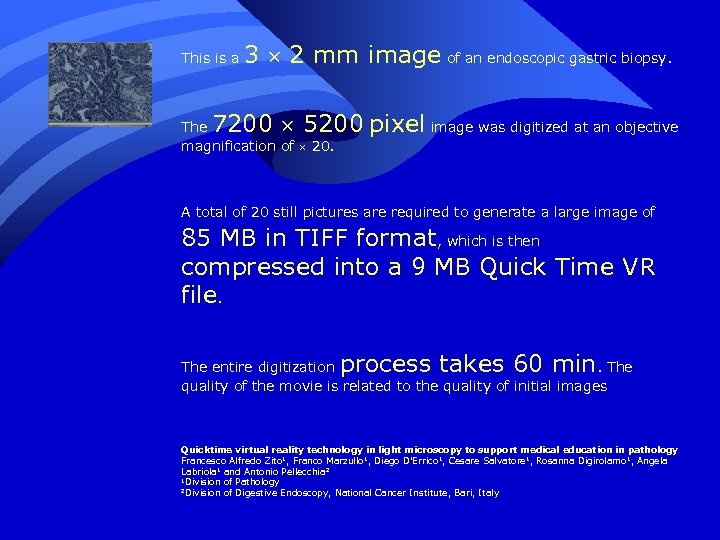 This is a 3 ´ 2 mm image of an endoscopic gastric biopsy. 7200