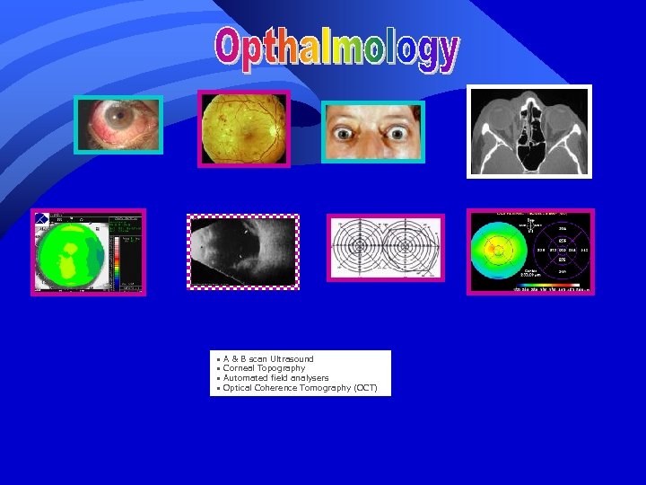  • A & B scan Ultrasound • Corneal Topography • Automated field analysers