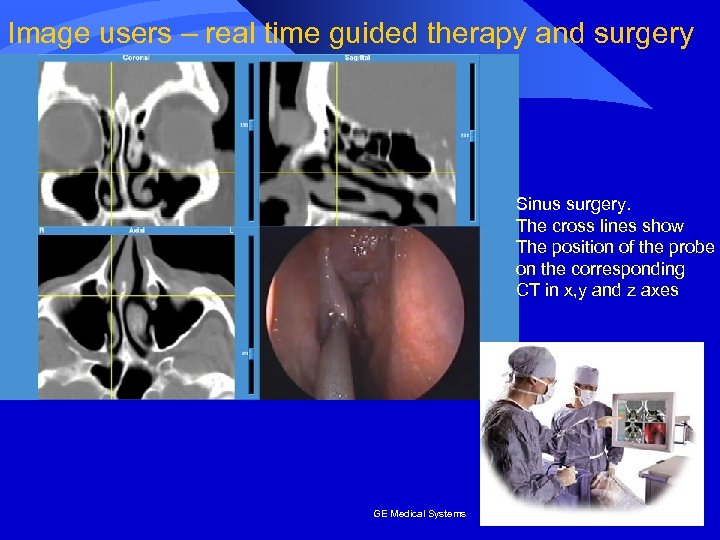 Image users – real time guided therapy and surgery Sinus surgery. The cross lines