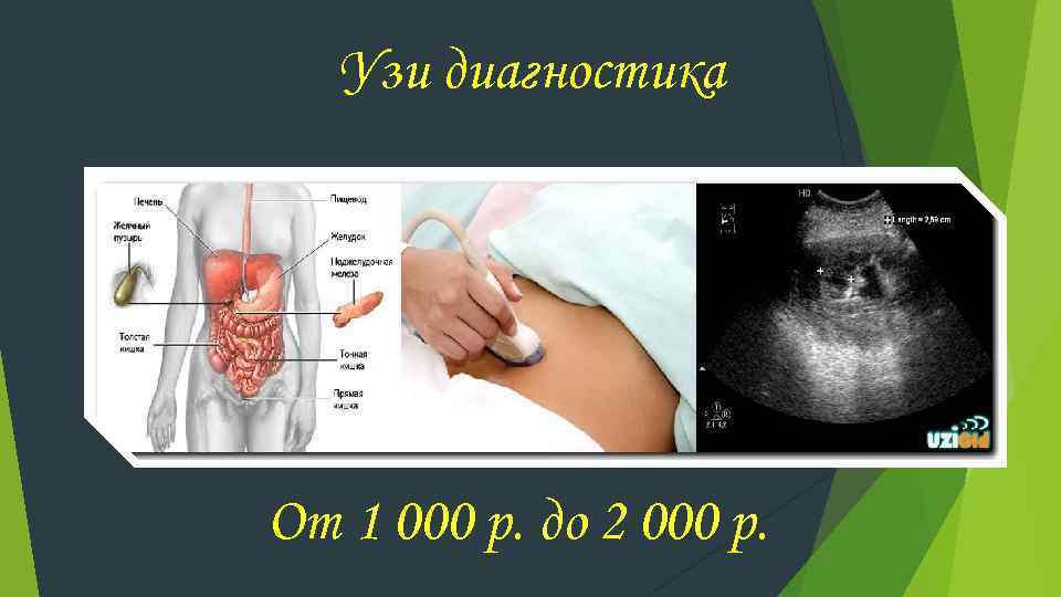 Узи диагностика От 1 000 р. до 2 000 р. 