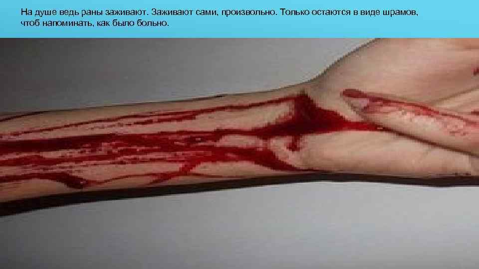 На душе ведь раны заживают. Заживают сами, произвольно. Только остаются в виде шрамов, чтоб