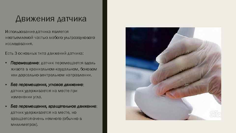 Движения датчика Использование датчика является неотъемлемой частью любого ультразвукового исследования. Есть 3 основных типа