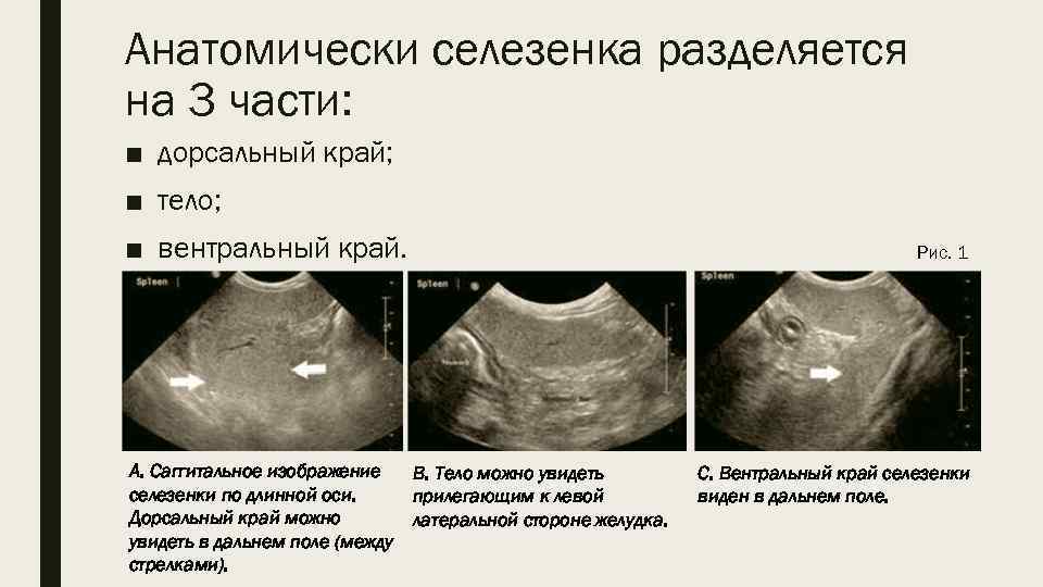 Воспаление селезенки на фоне интоксикации симптомы