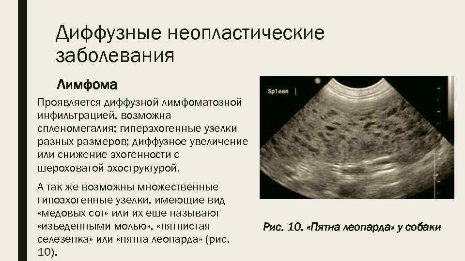 Диффузные неопластические заболевания Лимфома Проявляется диффузной лимфоматозной инфильтрацией, возможна спленомегалия; гиперэхогенные узелки разных размеров;