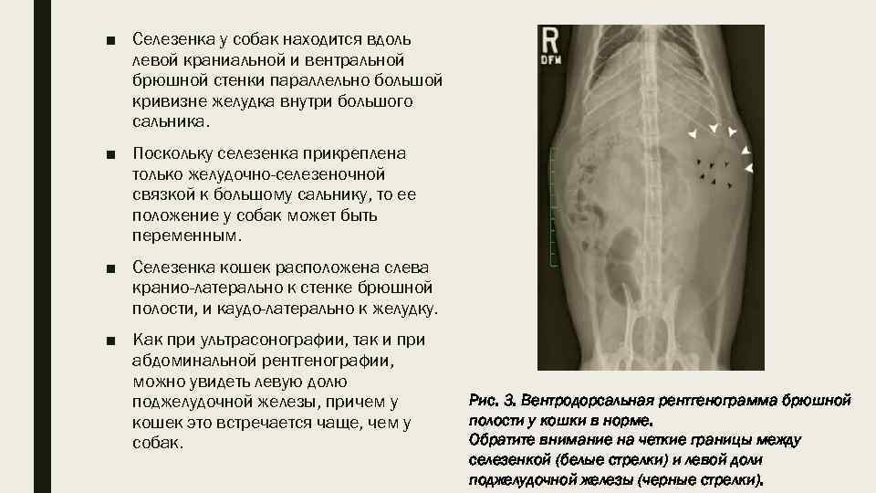 Разрыв селезенки можно выжить после