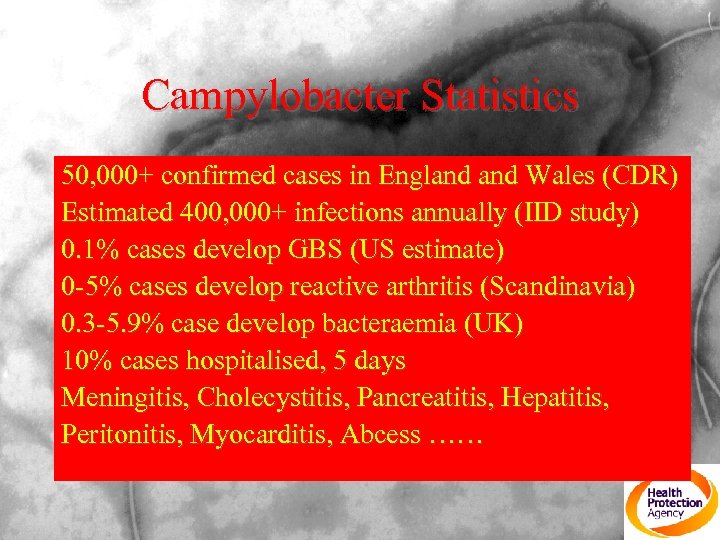 Campylobacter Statistics 50, 000+ confirmed cases in England Wales (CDR) Estimated 400, 000+ infections