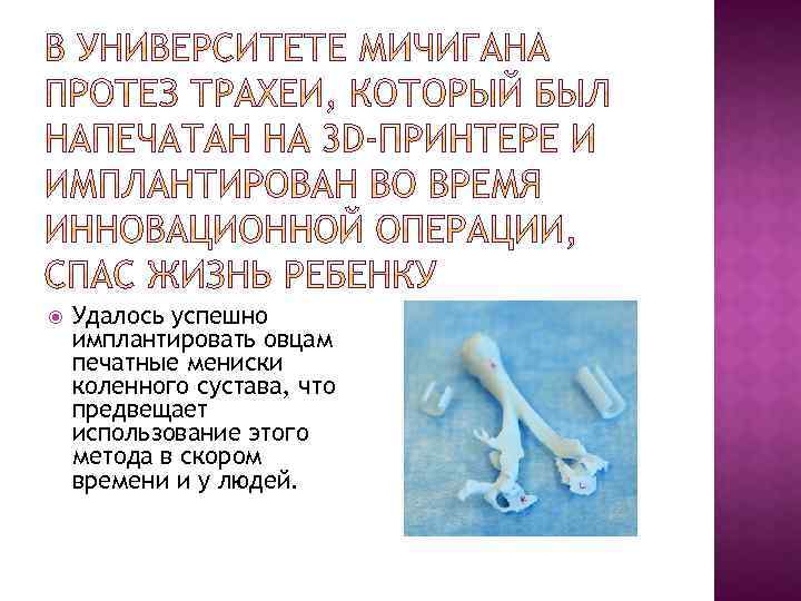  Удалось успешно имплантировать овцам печатные мениски коленного сустава, что предвещает использование этого метода