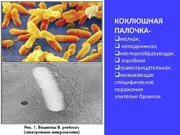 КОКЛЮШНАЯ ПАЛОЧКА- qмелкая, q неподвижная, qнеспорообразующая, q аэробная qграмотрицательная, qвызывающая специфическое поражение эпителия бронхов