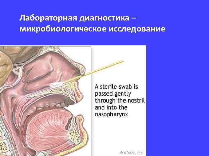 Лабораторная диагностика – микробиологическое исследование 