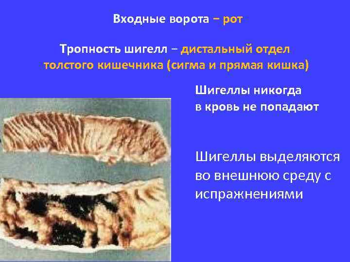 Входные ворота − рот Тропность шигелл − дистальный отдел толстого кишечника (сигма и прямая
