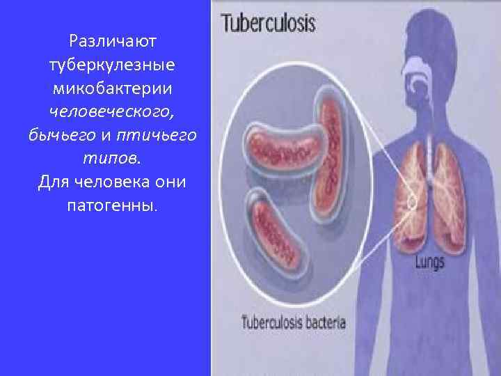 Различают туберкулезные микобактерии человеческого, бычьего и птичьего типов. Для человека они патогенны. 