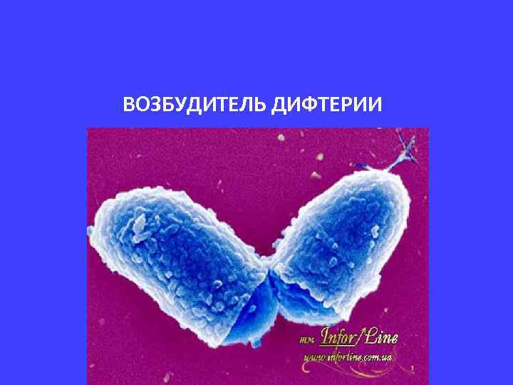 ВОЗБУДИТЕЛЬ ДИФТЕРИИ 