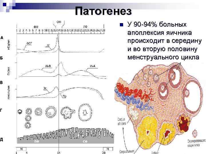 Патогенез n У 90 -94% больных апоплексия яичника происходит в середину и во вторую