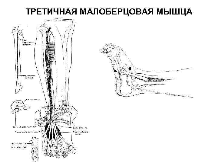 ТРЕТИЧНАЯ МАЛОБЕРЦОВАЯ МЫШЦА 