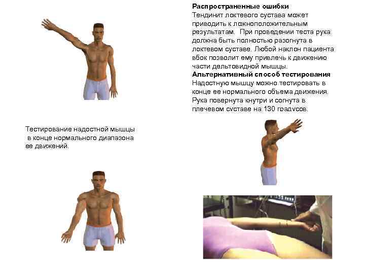 Распространенные ошибки Тендинит локтевого сустава может приводить к ложноположительным результатам. При проведении теста рука