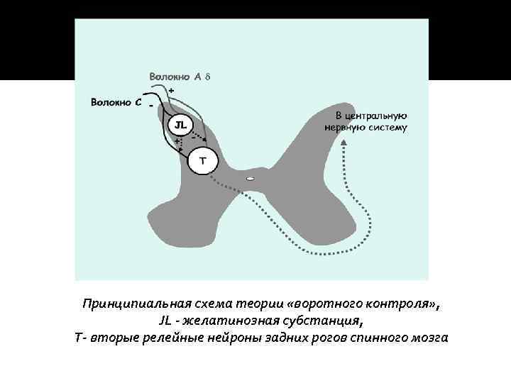 Принципиальная схема теории «воротного контроля» , JL - желатинозная субстанция, Т- вторые релейные нейроны