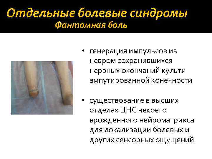 Отдельные болевые синдромы Фантомная боль • генерация импульсов из невром сохранившихся нервных окончаний культи