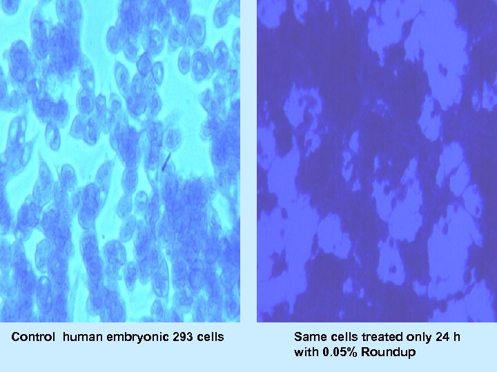 Control human embryonic 293 cells Same cells treated only 24 h with 0. 05%