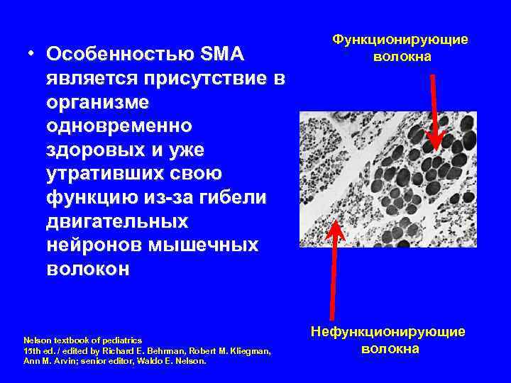  • Особенностью SMA является присутствие в организме одновременно здоровых и уже утративших свою