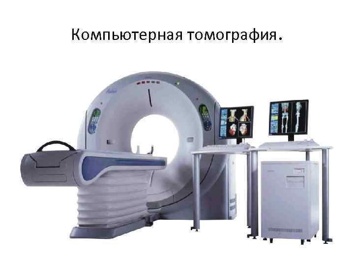 Компьютерная томография. 