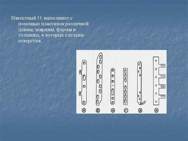 Накостный О. выполняют с помощью пластинок различной длины, ширины, формы и толщины, в которых