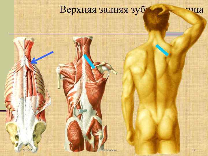 Верхняя задняя зубчатая мышца УГМА Миология 19 
