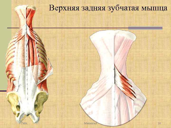 Верхняя задняя зубчатая мышца УГМА Миология 20 