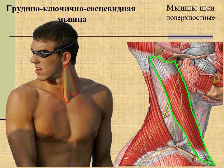 Грудино-ключично-сосцевидная мышца Мышцы шеи поверхностные 7 
