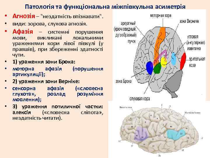 Патологія та функціональна міжпівкульна асиметрія • Агнозія – 